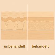 Konzentrat - RETINOL 0,3%